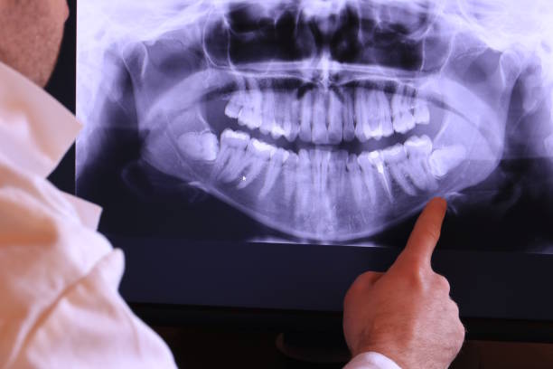 Best Emergency Root Canal Treatment in Park Ridge, NJ