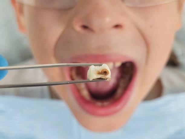 Best Walk-In Emergency Dentist in Park Ridge, NJ